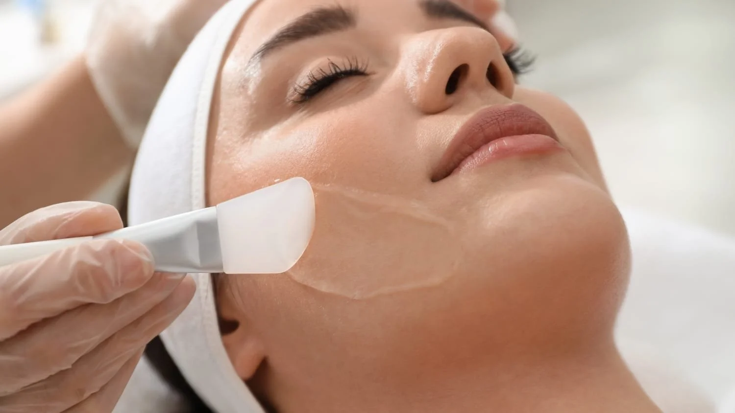 Professional skin peel treatment